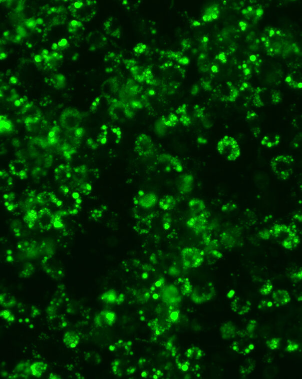 Adipocytes growing in cell culture media